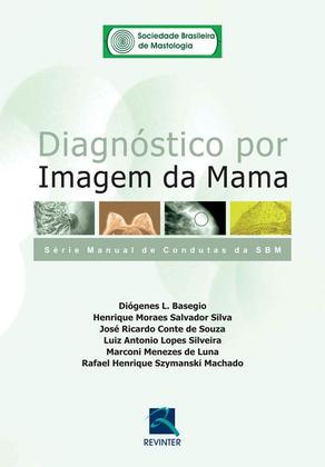 Imagem de Livro - SBM Diagnóstico por Imagem da Mama