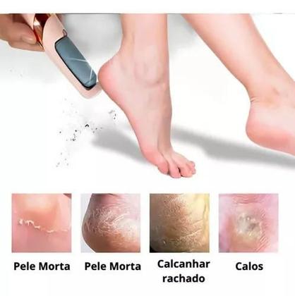 Imagem de Lixa Elétrica Pedicure USB Bivolt: Conveniência sem Limites para Pés Impecáveis