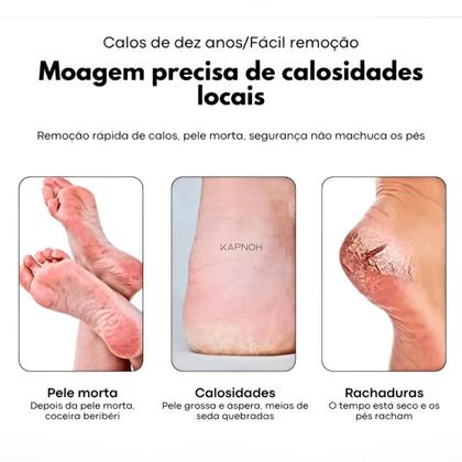 Lixa Para Pés Removedor de Calos Manual Pedicure Unhas Luxo - KR Variedades Imagem de Lixa Para Pés Removedor de Calos Manual Pedicure Unhas Luxo