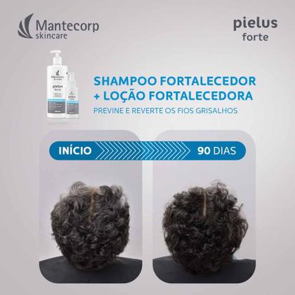 Imagem de Loção Fortalecedora Mantecorp Skincare Antiqueda Pielus Forte