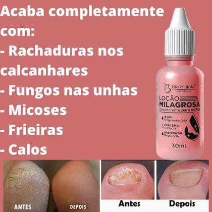 Imagem de Loção Milagrosa Bio Instinto Desodorante Para os Pés Frasco 30ml