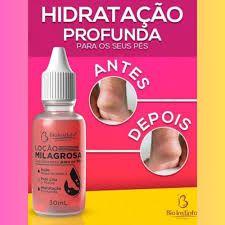 Imagem de Loção Milagrosa Desodorante Para Os Pés 30Ml - Bio Instinto