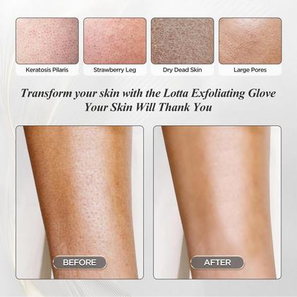 Imagem de Luva Esfoliante Lotta - Kit com 3 Peças (100% Viscose)