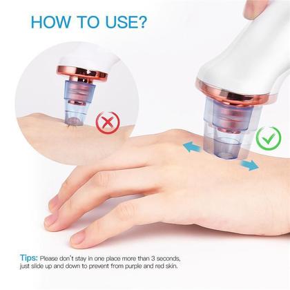 Imagem de Máquina Sucção A Vácuo Remove Cravo Aparelho Acne Cleaning