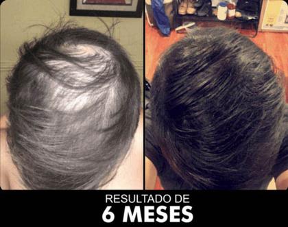 Imagem de Máscara De Crescimento Rápido Sublime Hair 300ml