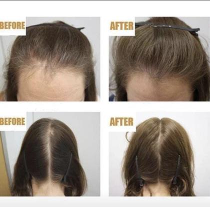 Imagem de Máscara Pantovin Fortificante Capilar  Three Therapy Cresce 3 X Mais 500ml