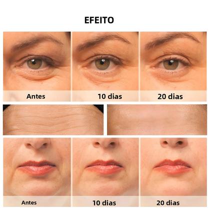 Imagem de Massageador Facial Anti-Envelhecimento EMS Microcorrente Para Lifting Facial E Aperto Da Pele