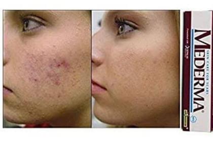 Imagem de Mederma Skin Care Cicatrizes Acnes E Estrias 10G-Usa