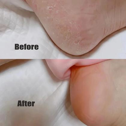 Imagem de Meia de Silicone Hidratação Pés Rachados Ressecados Anti Rachadura Tratamento Reutilizável - 1 Par