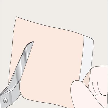 Imagem de Mepiform 5x7,5 Molnlycke