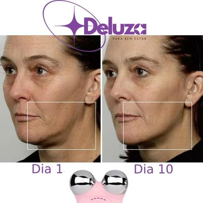 Imagem de Micro Lift Massageador Facial Microcorrente Lifting Do Rosto