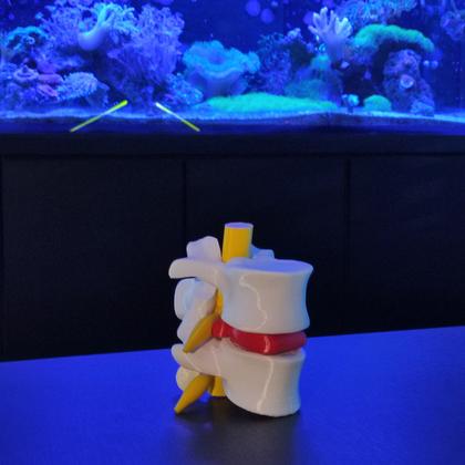 Imagem de Modelo Anatômico Hérnia Disco Lombar Coluna Vertebral Ortopedia 3D