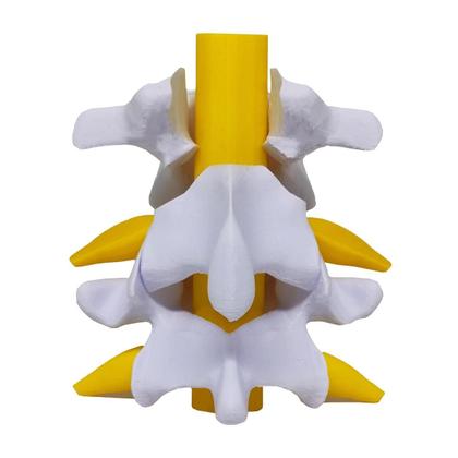 Imagem de Modelo Anatômico Hérnia Disco Lombar Coluna Vertebral