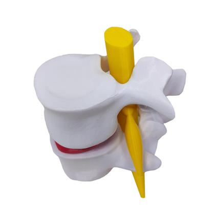 Imagem de Modelo Anatômico Hérnia Disco Lombar Coluna Vertebral
