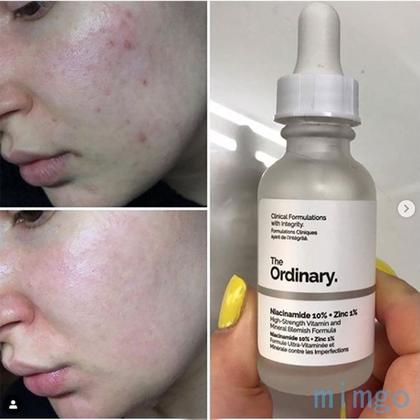 Imagem de Niacinamide 10% + Zinc 1%, The Ordinary