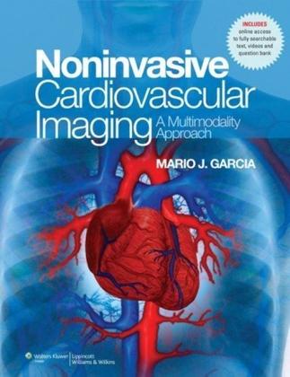 Imagem de Noninvasive Cardiovascular Imaging: a Multimodality Approach