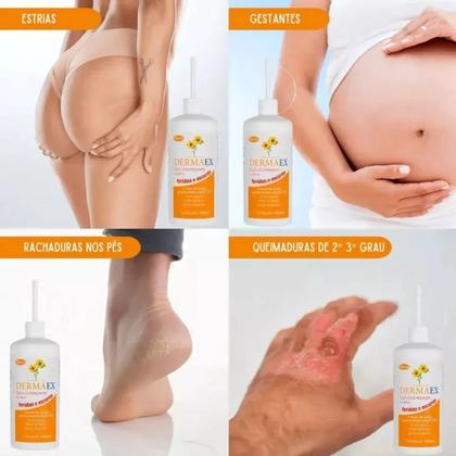 Imagem de Óleo De Girassol Cicatrizante Dermaex 200ml