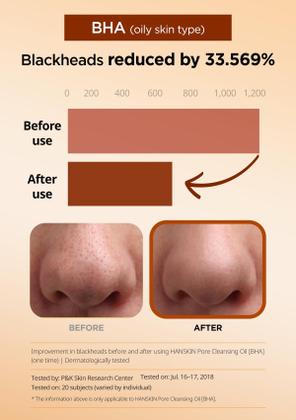 Imagem de Óleo de limpeza Hanskin BHA Pore Gentle Blackhead 300mL