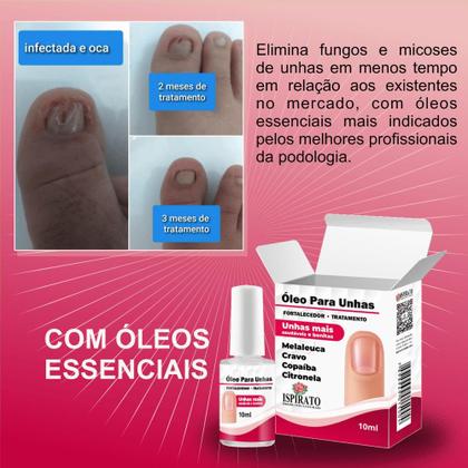 Imagem de Óleo Ispirato Para Unhas Com Micose 10ml