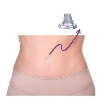 Imagem de Órtese Umbilical Conformador Pós-cirurgia 1 unidade Envio Imediato