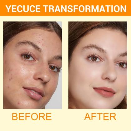 Imagem de Pacote com 2 mousse de limpeza de açafrão, limpador facial com ácido kójico para lavar o rosto e firmar a pele, remova o excesso de queratina e limpe profundamente os poros 150 ml