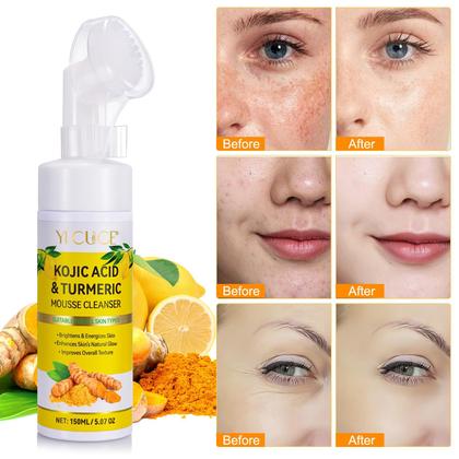 Imagem de Pacote com 2 mousse de limpeza de açafrão, limpador facial com ácido kójico para lavar o rosto e firmar a pele, remova o excesso de queratina e limpe profundamente os poros 150 ml