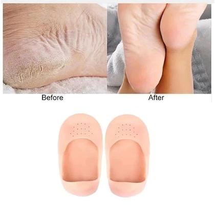 Imagem de Par Protetor Calcanhar Silicone Gel Meia Respirável Anti Odor Nude Original Top Promo