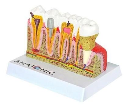 Imagem de Patologia Dentária E Placa Explicativa Em 2 Partes, Anatomia