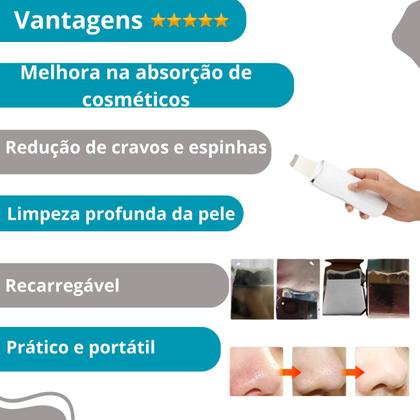 Imagem de Peeling Ultrassônico Portátil para Limpeza Profunda e Tira Cravos