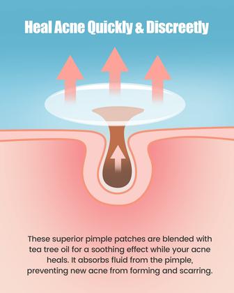 Imagem de Pimple Patch Jefusst 210 conta com 4 tamanhos com melaleuca e calêndula