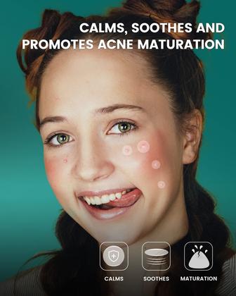 Imagem de Pimple Patch Jefusst 210 conta com 4 tamanhos com melaleuca e calêndula