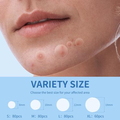 Imagem de Pimple Patches Daolyo 300, hidrocolóide com ácido salicílico