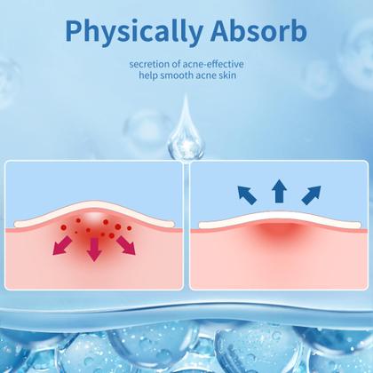 Imagem de Pimple Patches Daolyo 300, hidrocolóide com ácido salicílico