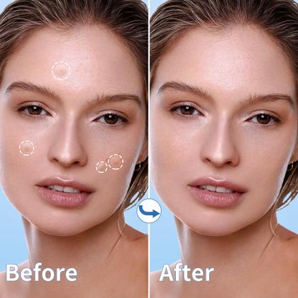 Imagem de Pimple Patches Daolyo 300, hidrocolóide com ácido salicílico