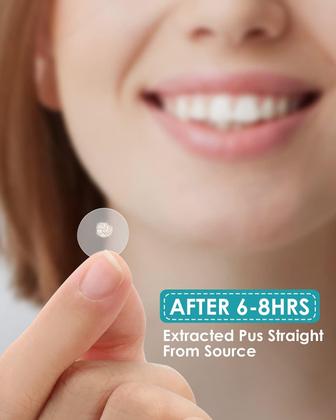 Imagem de Pimple Patches HeroLabs com óleo de melaleuca vegano (288 unidades)