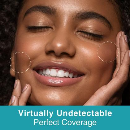 Imagem de Pimple Patches HeroLabs com óleo de melaleuca vegano (288 unidades)