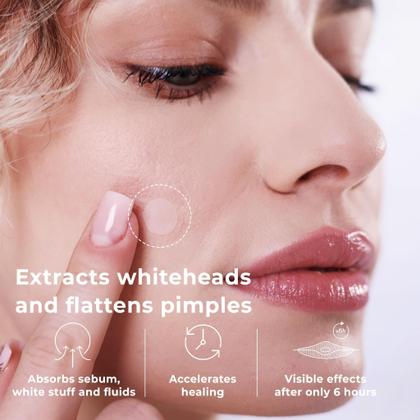 Imagem de Pimple Patches, hidrocolóide coreano OMMA, 10 mm (72 unidades)