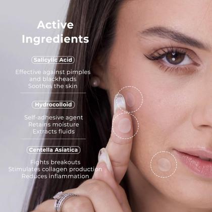 Imagem de Pimple Patches, hidrocolóide coreano OMMA, 10 mm (72 unidades)
