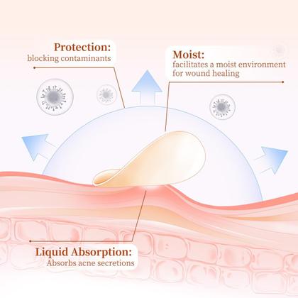 Imagem de Pimple Patches SOVEE 96 unidades de hidrocolóide com ácido salicílico