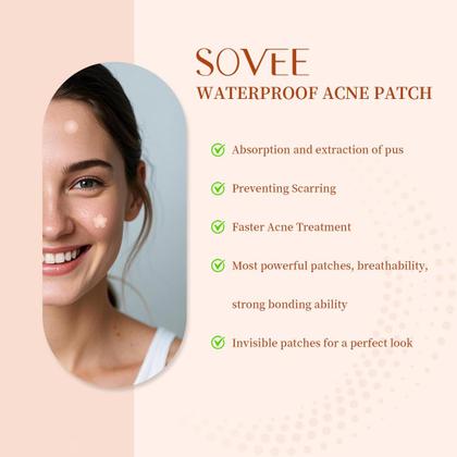 Imagem de Pimple Patches SOVEE 96 unidades de hidrocolóide com ácido salicílico