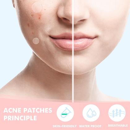 Imagem de Pimple Patches sundpik para rosto com ácido salicílico 230 unidades