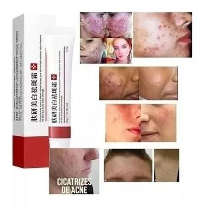 Imagem de Pomada Creme Clareia Manchas Sardas Melasma Ebug 20g