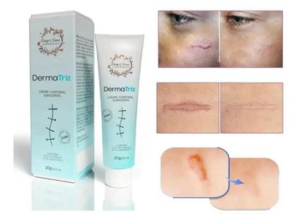 Imagem de Pomada Creme Com Alantoína Cicatrizante Para Cicatriz DermaTriz.