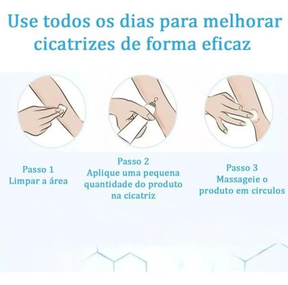 Imagem de Pomada Creme Para Tratamento Cicatriz DermaTriz 20g.