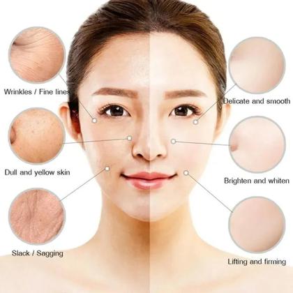 Imagem de Pomada Reparação Facial Clareamento Sardas Manchas Melasma eb