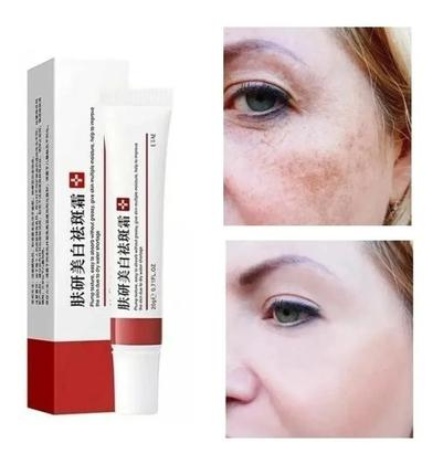 Imagem de Pomada Reparação Facial Clareamento Sardas Manchas Melasma eb