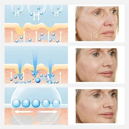 Imagem de Pomada Reparação Facial Clareamento Sardas Manchas Melasma eb