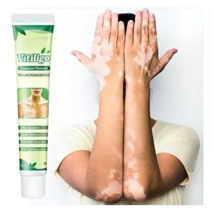 Imagem de Pomada Tratamento Vitiligo Sumifun