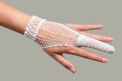 Imagem de Poolfix rede tubular elastica calibre 3 (21mm)