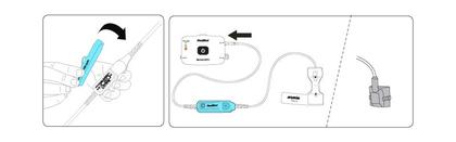 Imagem de Presilha para XPOD de oximetria do ApneaLink Air - ResMed